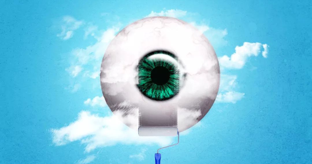 نصائح بعد عملية الليزك