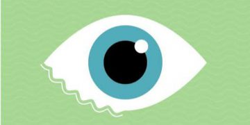 نفضة العين Eye twitch