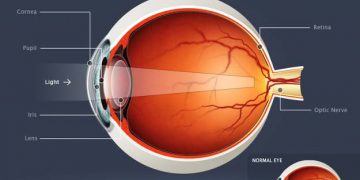 طول النظر (مد البصر)