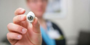 القشرة التعويضية Shell prosthetic