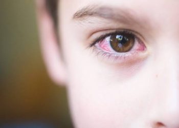 الرمد الربيعي Spring catarrh