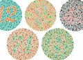 اختبار ايشيهارا ISHIHARA TEST
