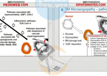 The pathogenesis of diabetic microangiopathy
