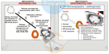 The pathogenesis of diabetic microangiopathy