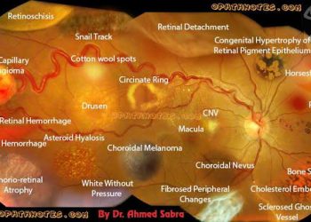 Retinal Lesion Differential Diagnosis