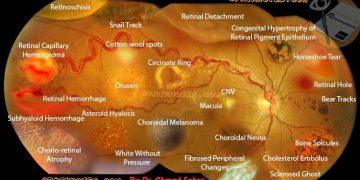 Retinal Lesion Differential Diagnosis