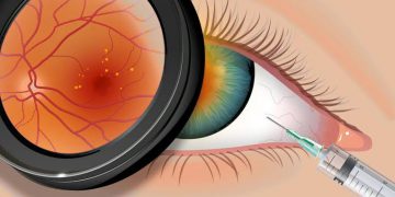 Commonly used drugs for HIV in endophthalmitis