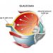 Normal Tension glaucoma (NTG) capsule