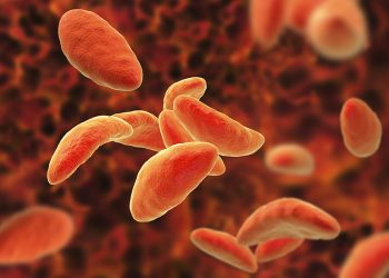 Ocular Toxoplasmosis