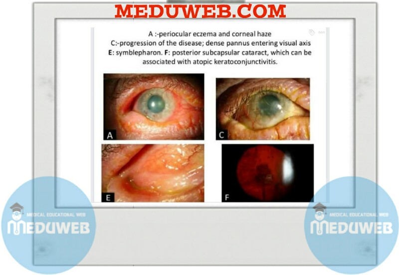 Untitled211 800x551 3