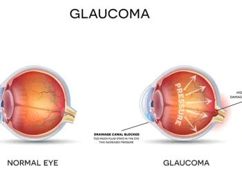 Glaucoma triad under controversy