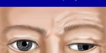 When to send a patient for MRI in a case of 3rd nerve palsy and why ?