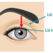 Examining the eye lids hints