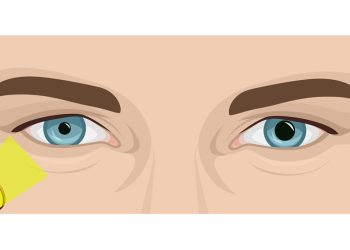 Clinical hints for Your approach for examining the pupils