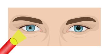 Clinical hints for Your approach for examining the pupils