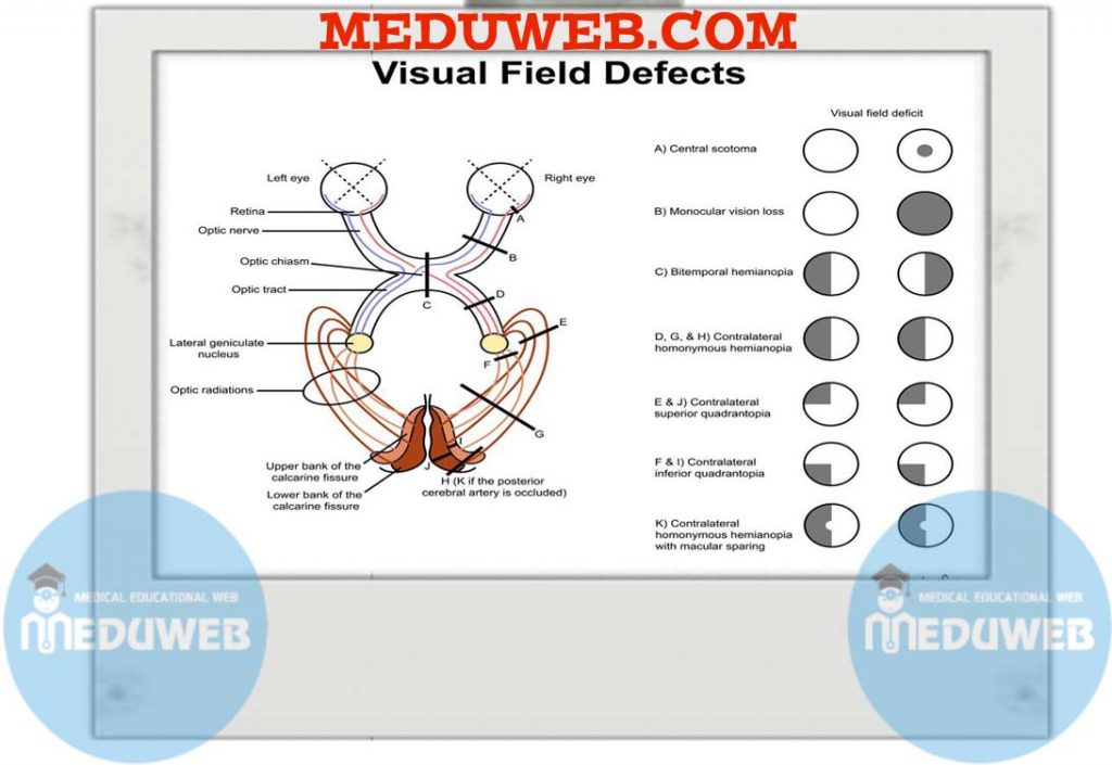Untitled1 1024x705 1