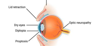 Emergencies ( sight threatening ) in TED