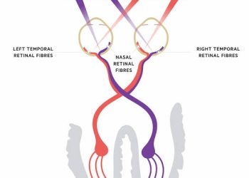 Summary of visual field defects