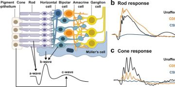 Notes on the Electroretinogram  ERG response