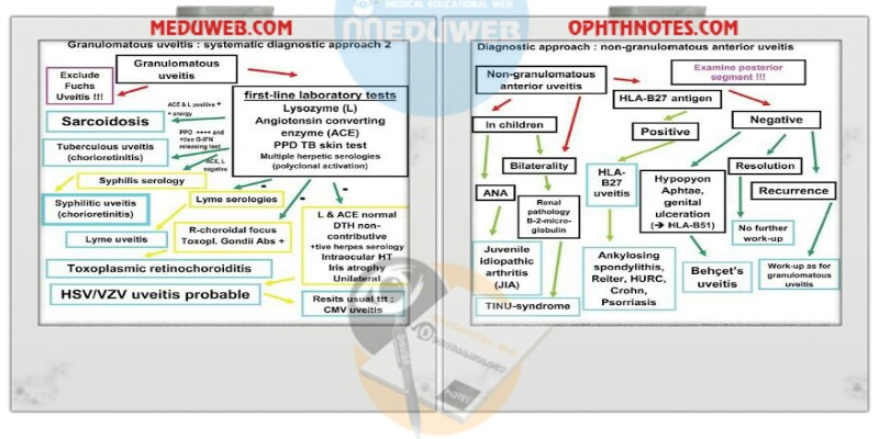 Clinical approach to Uveitis