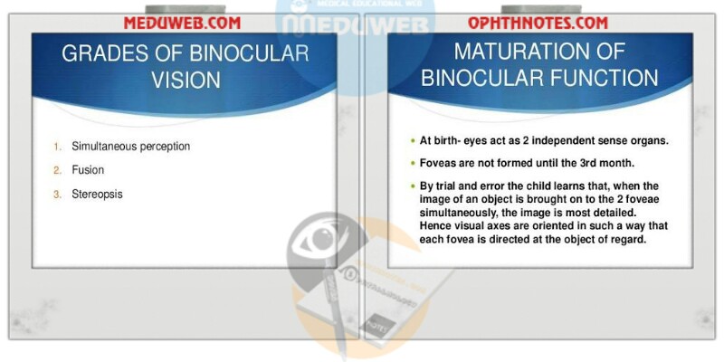 Binocular single vision what u have to know