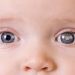 Pediatric cataracts