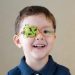Amblyopia what you should know