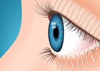 Meibomian gland dysfunction