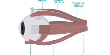 Clinical notes on EOM