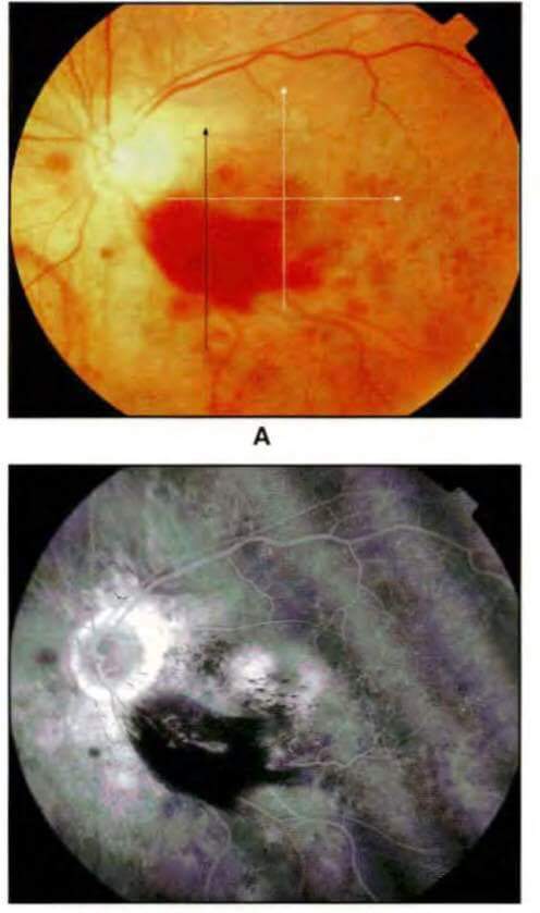 FB IMG 1511426030998