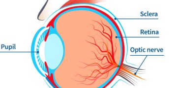 Retinopathy of Prematurity (ROP) screening guidelines