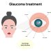 Anti-glaucoma drugs in pregnant and lactating women is always debatable issue