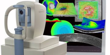 Optical coherence tomography ( OCT)