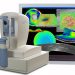 Optical coherence tomography ( OCT)