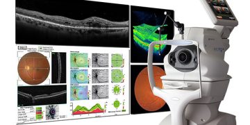 OCT interpretation capsules