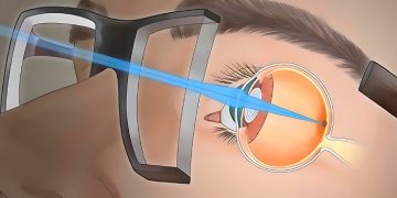 كيف تعمل النظارات الطبيه علي تصحيح عيوب الابصار ؟